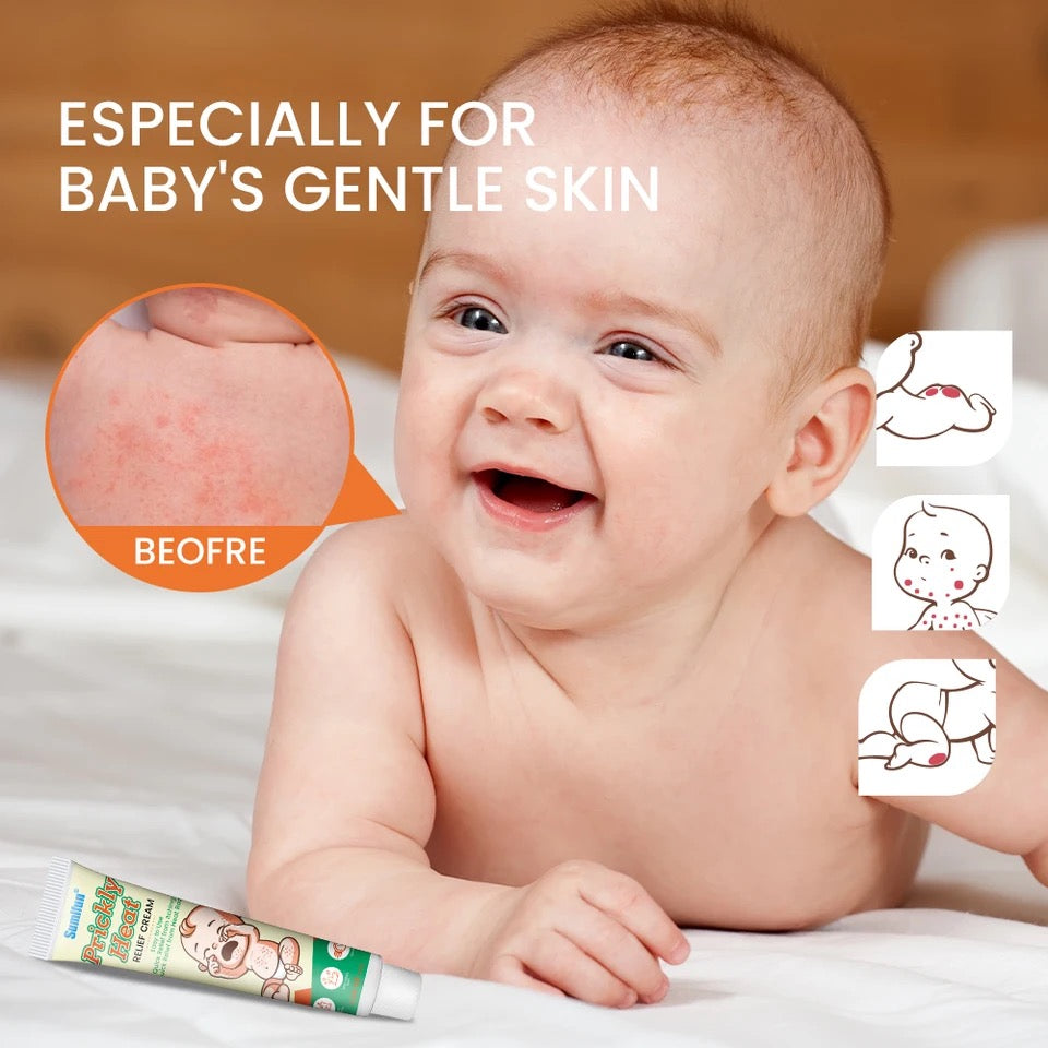 Prickly Heat Relief Cream for Babies | Topical Cream for Dermatitis, Eczema, Mosquito Bites, Itching, and Rashes on Babies - Image 5