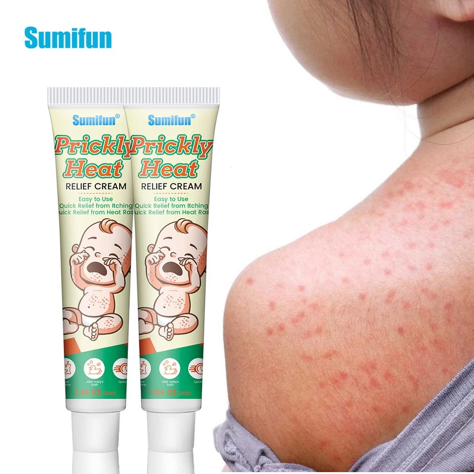 Prickly Heat Relief Cream for Babies | Topical Cream for Dermatitis, Eczema, Mosquito Bites, Itching, and Rashes on Babies - Image 4
