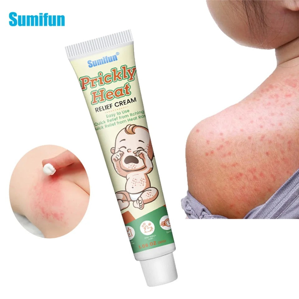 Prickly Heat Relief Cream for Babies | Topical Cream for Dermatitis, Eczema, Mosquito Bites, Itching, and Rashes on Babies - Image 6