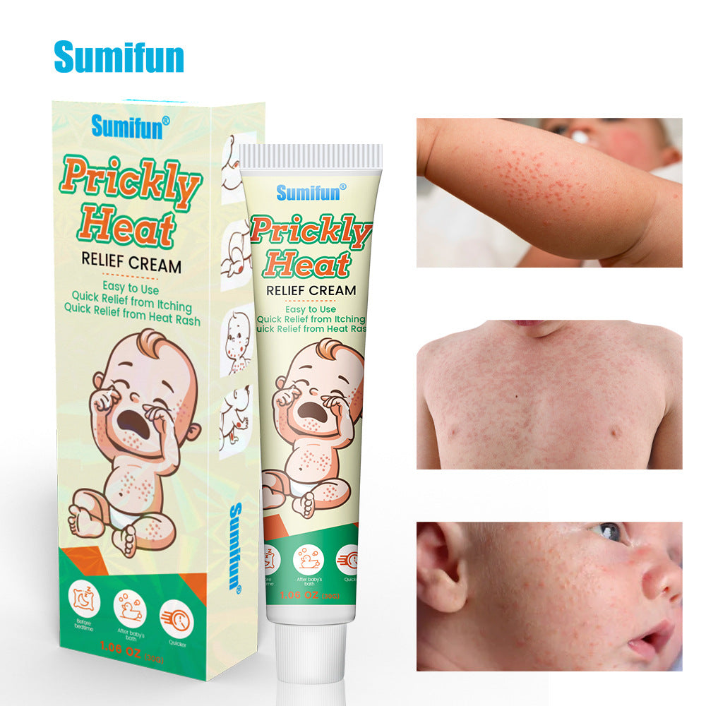 Prickly Heat Relief Cream for Babies | Topical Cream for Dermatitis, Eczema, Mosquito Bites, Itching, and Rashes on Babies