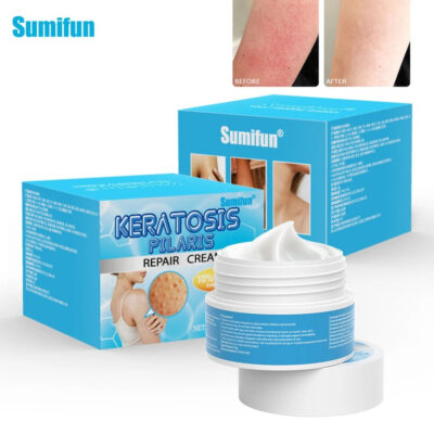 Keratosis Pilaris Repair Cream with Vitamin E and Urea (30 grams) | Topical Cream for Goosebumps, Large Skin Pores, Dark and Rough Skin