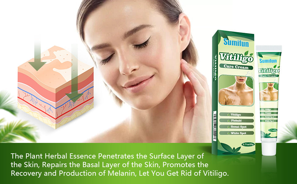 Vitiligo Care Cream | Topical Ointment for White Spots, Piebald, and Vitiligo - Image 15