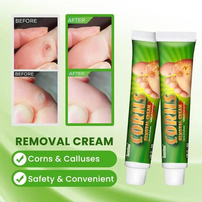 Corns Removal Cream | Topical Cream for Foot Warts, Foot Corns, and Calluses - Image 2