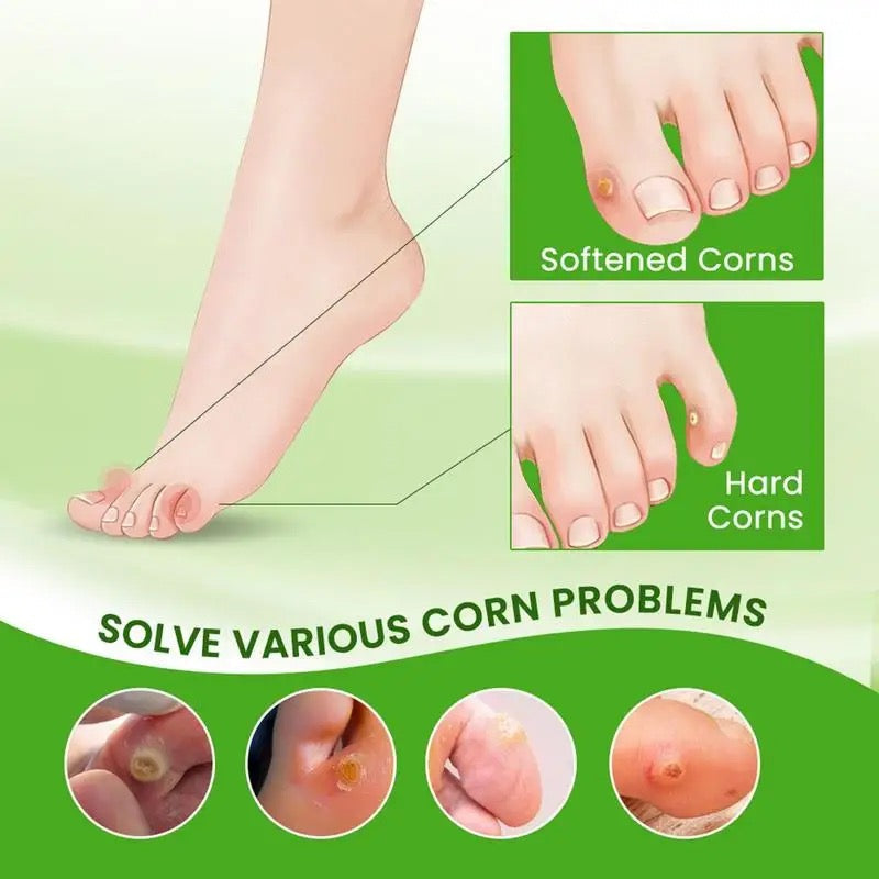 Corns Removal Cream | Topical Cream for Foot Warts, Foot Corns, and Calluses - Image 3