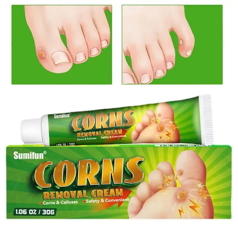 Corns Removal Cream | Topical Cream for Foot Warts, Foot Corns, and Calluses - Image 4