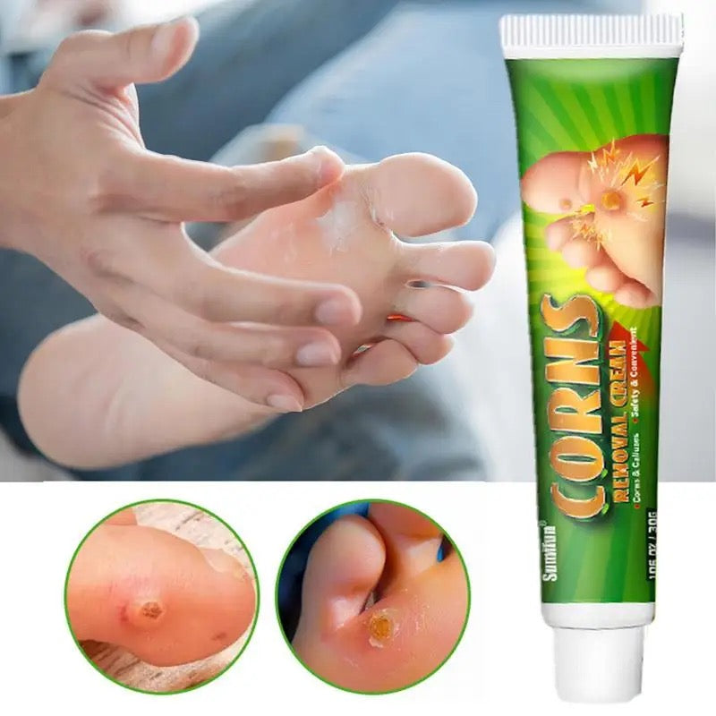 Corns Removal Cream | Topical Cream for Foot Warts, Foot Corns, and Calluses - Image 5