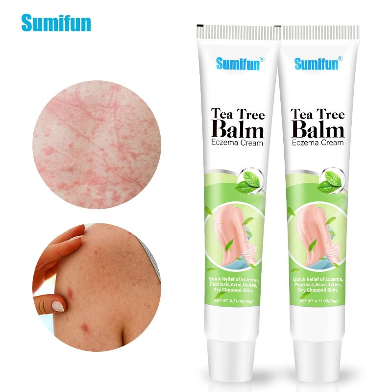 Tea Tree Oil Balm | Topical Cream for Eczema, Psoriasis, Acne, Itches, and Dry Chapped Skin - Image 7