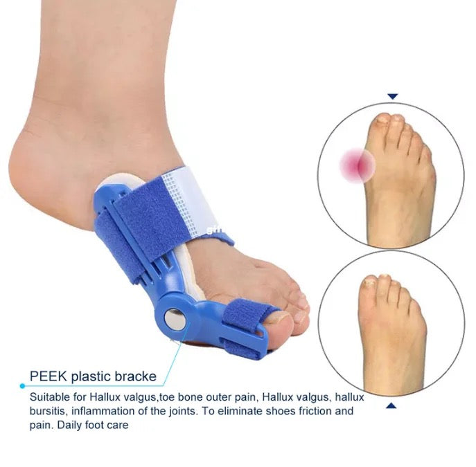 Bunion Corrector | Hallus Valgus Corrector | Orthopedic Bunion Splint - Image 16