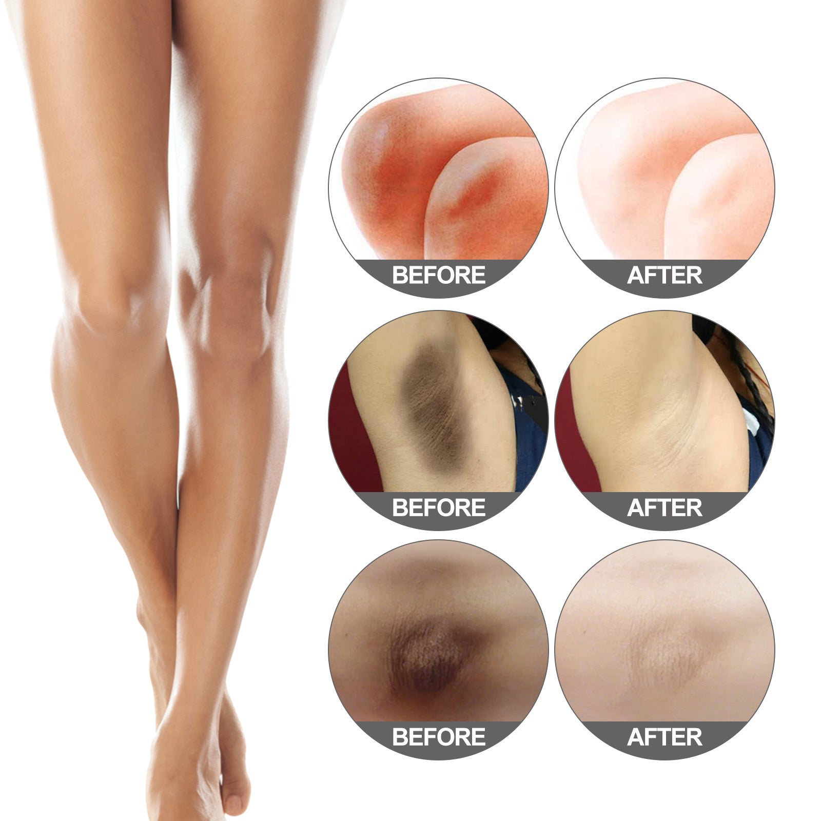 JAYSUING Snow Bleach Intensive Cream for Face and Body (50g) - Image 6
