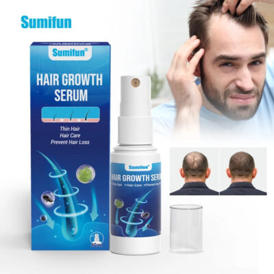 Hair Growth Spray | Topical Spray for Alopecia Baldness, Hair Loss, and Hair Care