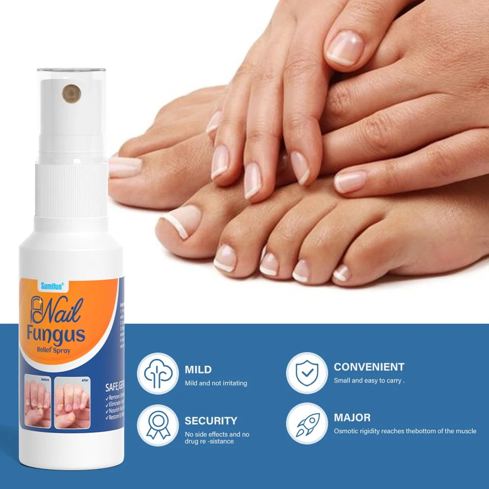 Nail Fungus Relief Spray | Topical Spray for Infected, Damaged and Discolored Nails - Image 4