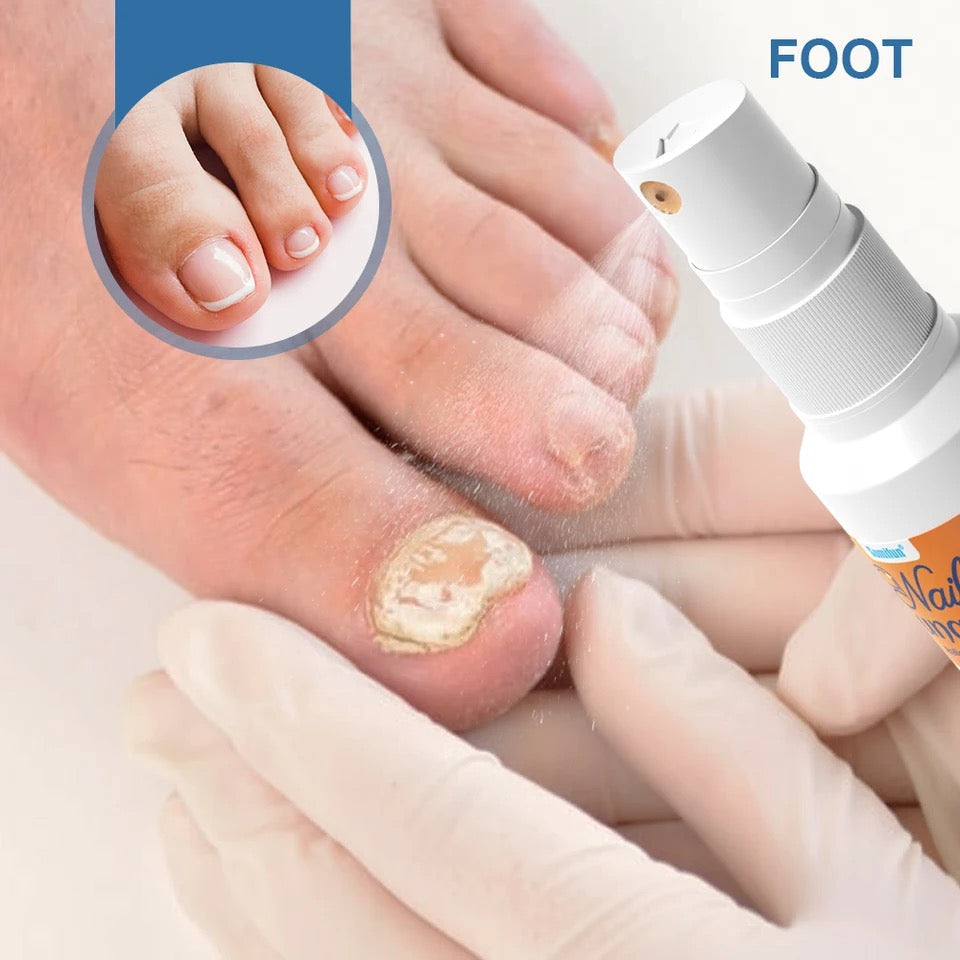 Nail Fungus Relief Spray | Topical Spray for Infected, Damaged and Discolored Nails - Image 5