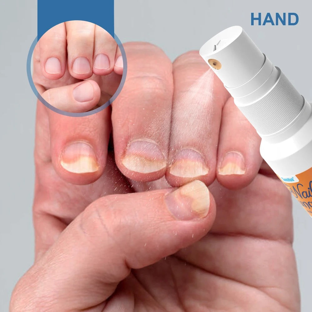 Nail Fungus Relief Spray | Topical Spray for Infected, Damaged and Discolored Nails - Image 7