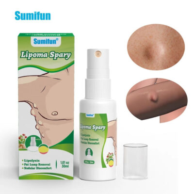 Lipoma Spray | Topical Spray for Skin Lump, Benign Lipoma and Tumor