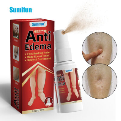 Anti-Edema Spray | Topical Spray for Foot Edema