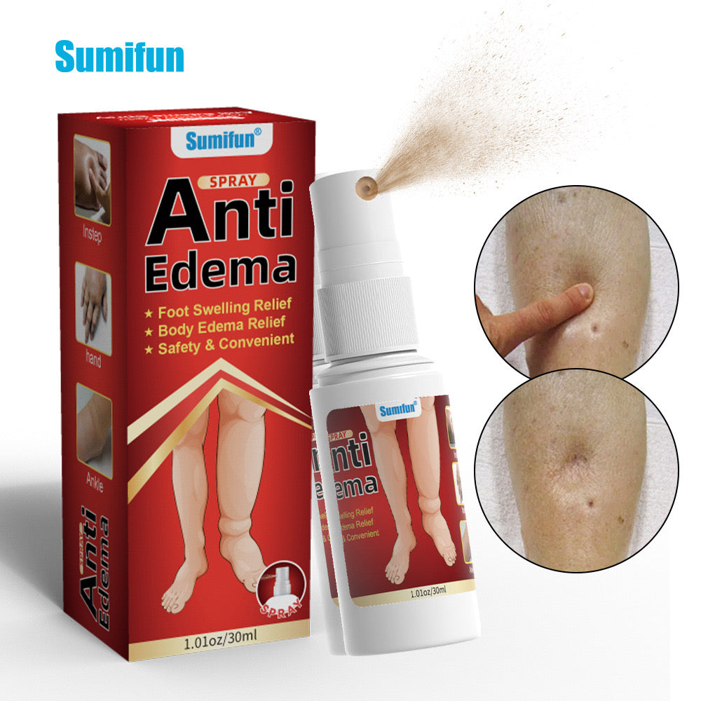 Anti-Edema Spray | Topical Spray for Foot Edema