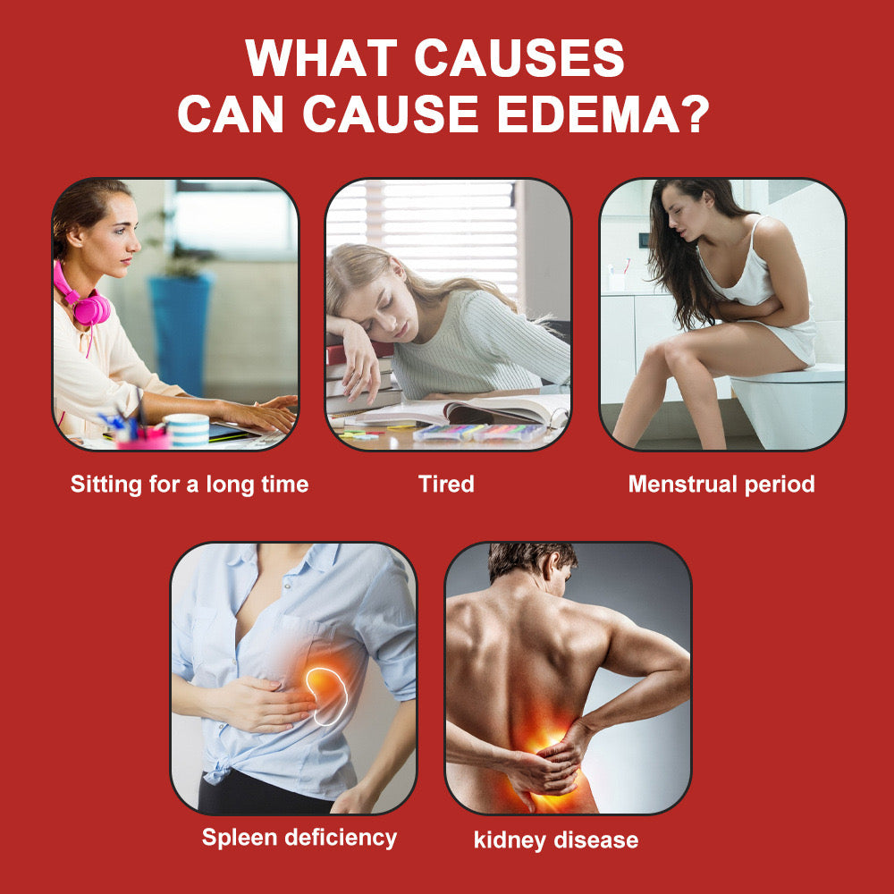 Anti-Edema Spray | Topical Spray for Foot Edema - Image 7