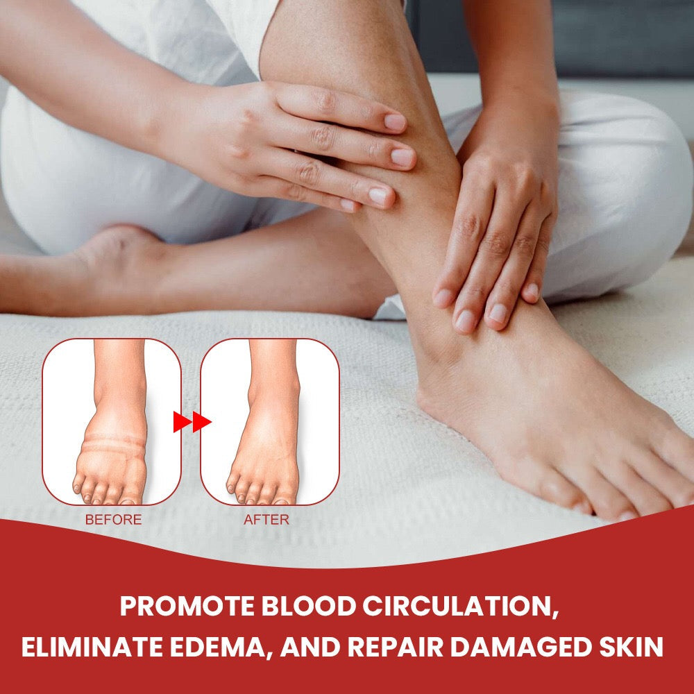 Anti-Edema Spray | Topical Spray for Foot Edema - Image 3