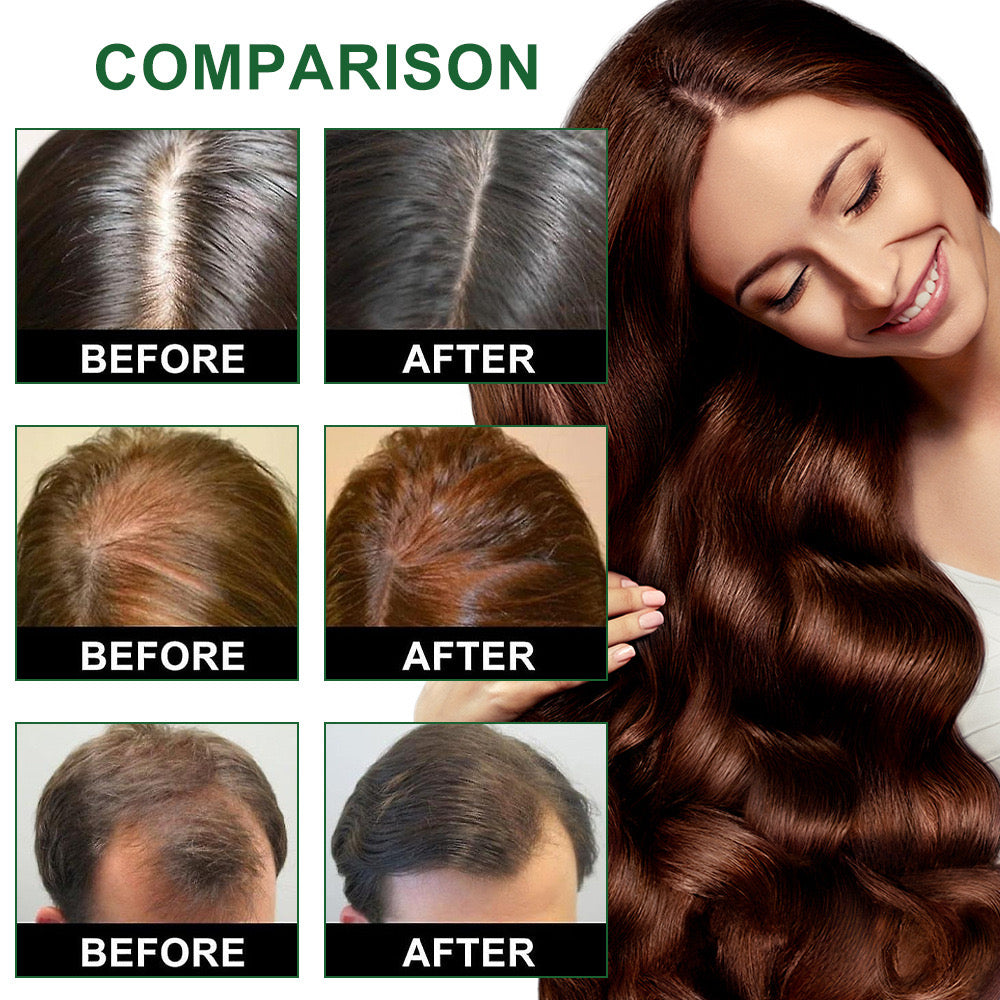 Hair Follicle Hair Cream - Image 5