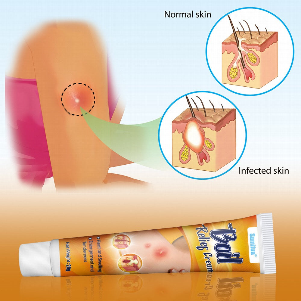 Boil Relief Cream - Image 6