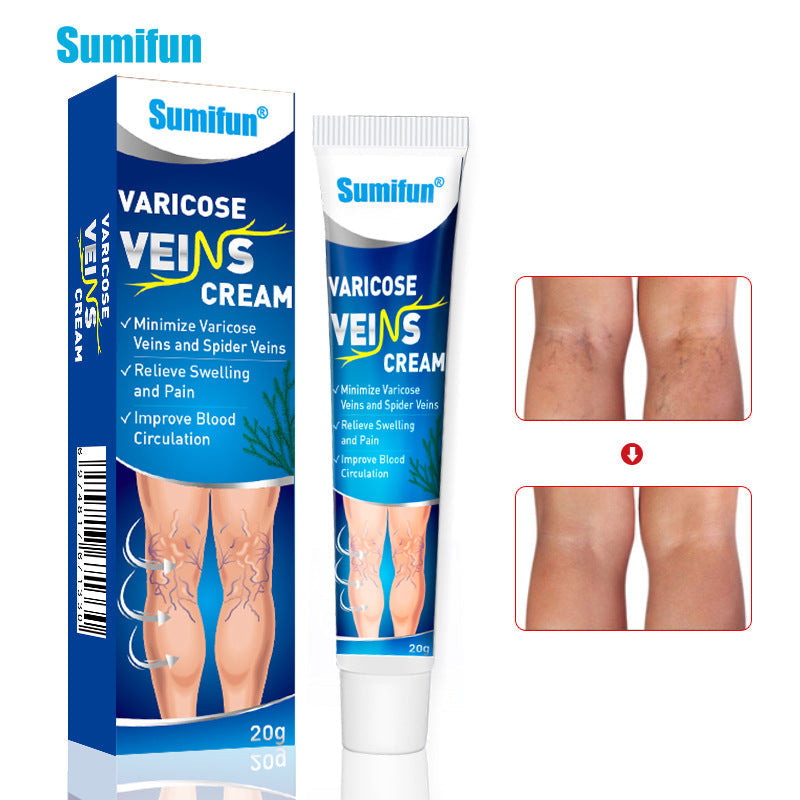 Varicose Veins Cream | Herbal Cream for Spider Veins and Varicose Veins - Image 5