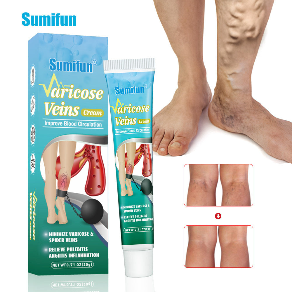 Varicose Veins Cream | Topical Cream for Varicose Veins and Spider Veins - Image 2
