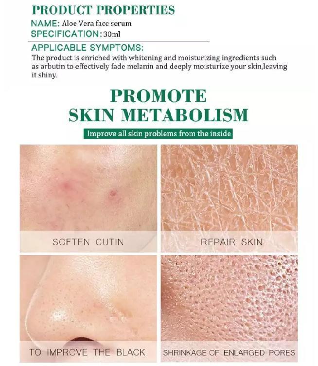 Aloe Vera Face Serum | Anti-Aging, Anti-Wrinkles and Moisturizing Face Serum - Image 6