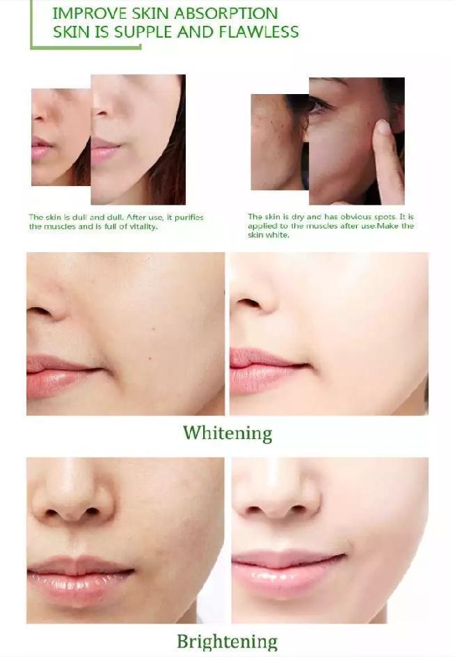Aloe Vera Face Serum | Anti-Aging, Anti-Wrinkles and Moisturizing Face Serum - Image 8