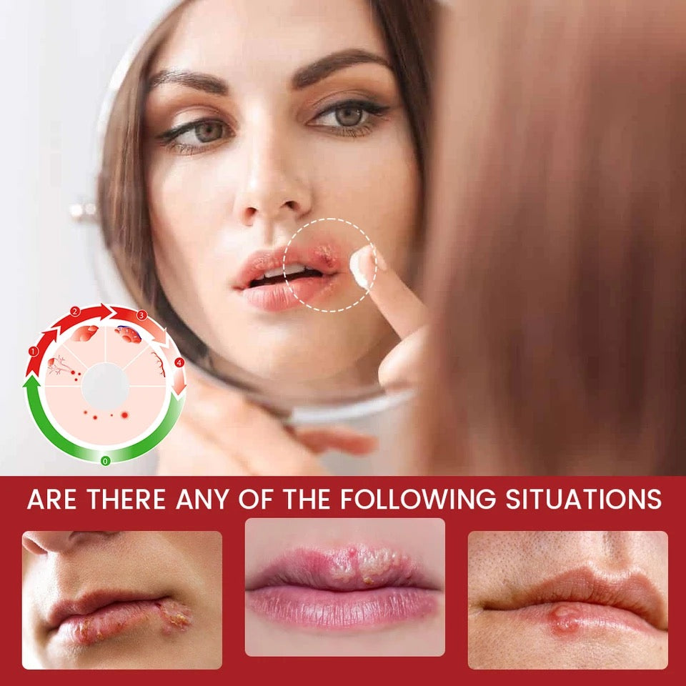 Cold Sore Relief Cream - Image 3