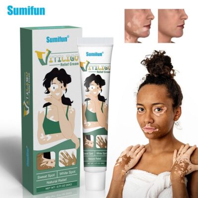 Vitiligo Relief Cream | Topical Ointment for White Spots, Leukoplakia, Sweat Spots, Piebald, Mottle, and Vitiligo