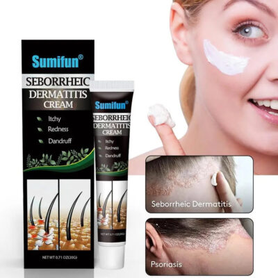 Seborrheic Dermatitis Cream | Herbal Cream for Treating Dermatitis, Psoriasis, and Dandruff