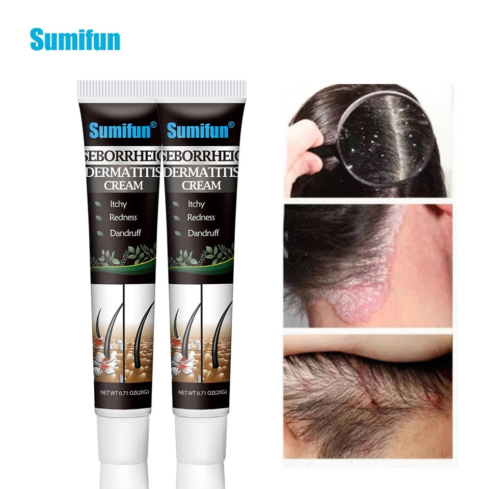 Seborrheic Dermatitis Cream | Herbal Cream for Treating Dermatitis, Psoriasis, and Dandruff - Image 8