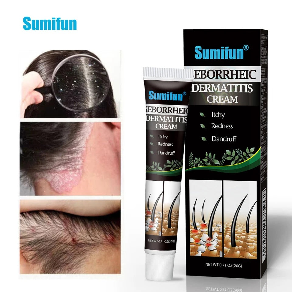 Seborrheic Dermatitis Cream | Herbal Cream for Treating Dermatitis, Psoriasis, and Dandruff - Image 2
