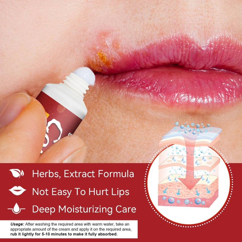 Cold Sore Relief Cream - Image 2