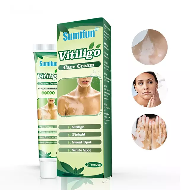 Vitiligo Care Cream | Topical Ointment for White Spots, Piebald, and Vitiligo - Image 3