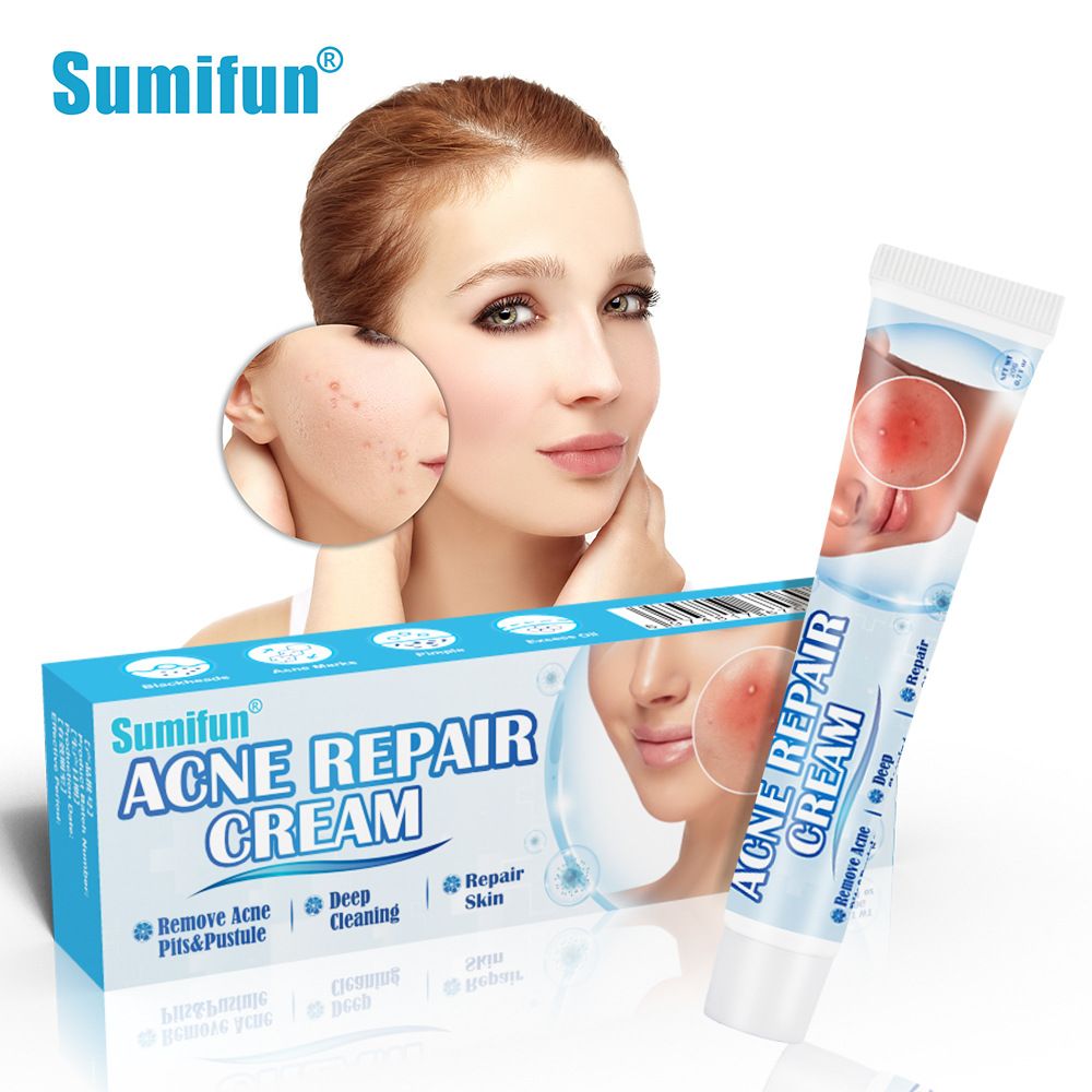 Acne Repair Cream | Herbal Ointment for Pimples, Acne Marks, Postules, and Blackheads - Image 6