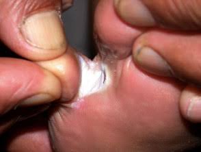 Foot Care Cream | Herbal Cream for Athlete's Foot, Itchy Feet and Foot Infections - Image 4