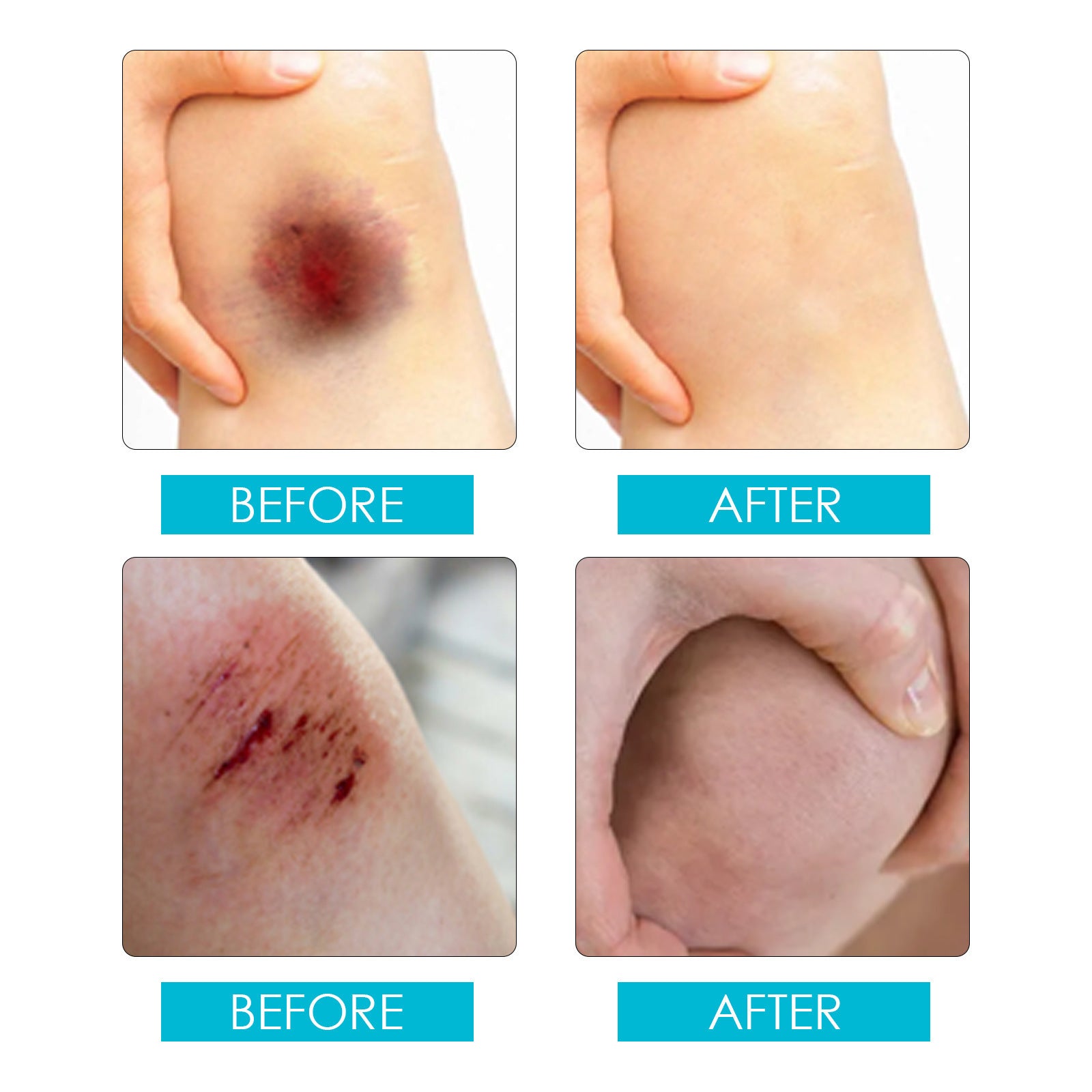 Liquid Wound Dressing | Liquid First Aid for Cuts and Wounds - Image 9