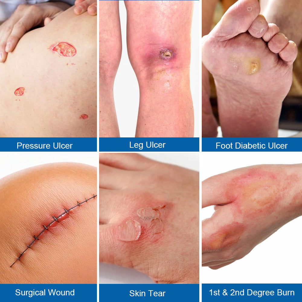 Silicone Gel Dressing (2 pieces/pack) | Waterproof and Breathable Band Aid for Wound Dressing - Image 9