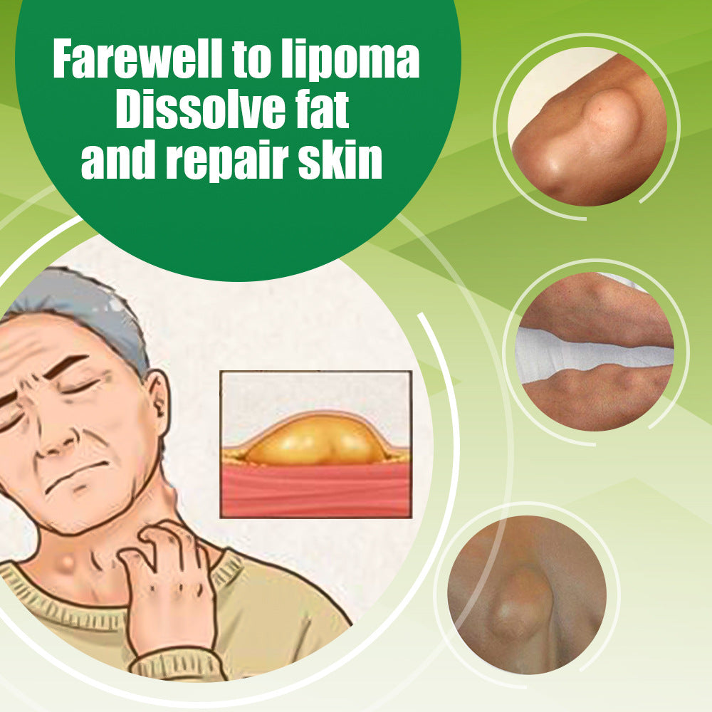 Lipoma Roll-On | Topical Ointment for Lipolysis, Fat Lump, and Nodular Discomfort - Image 4
