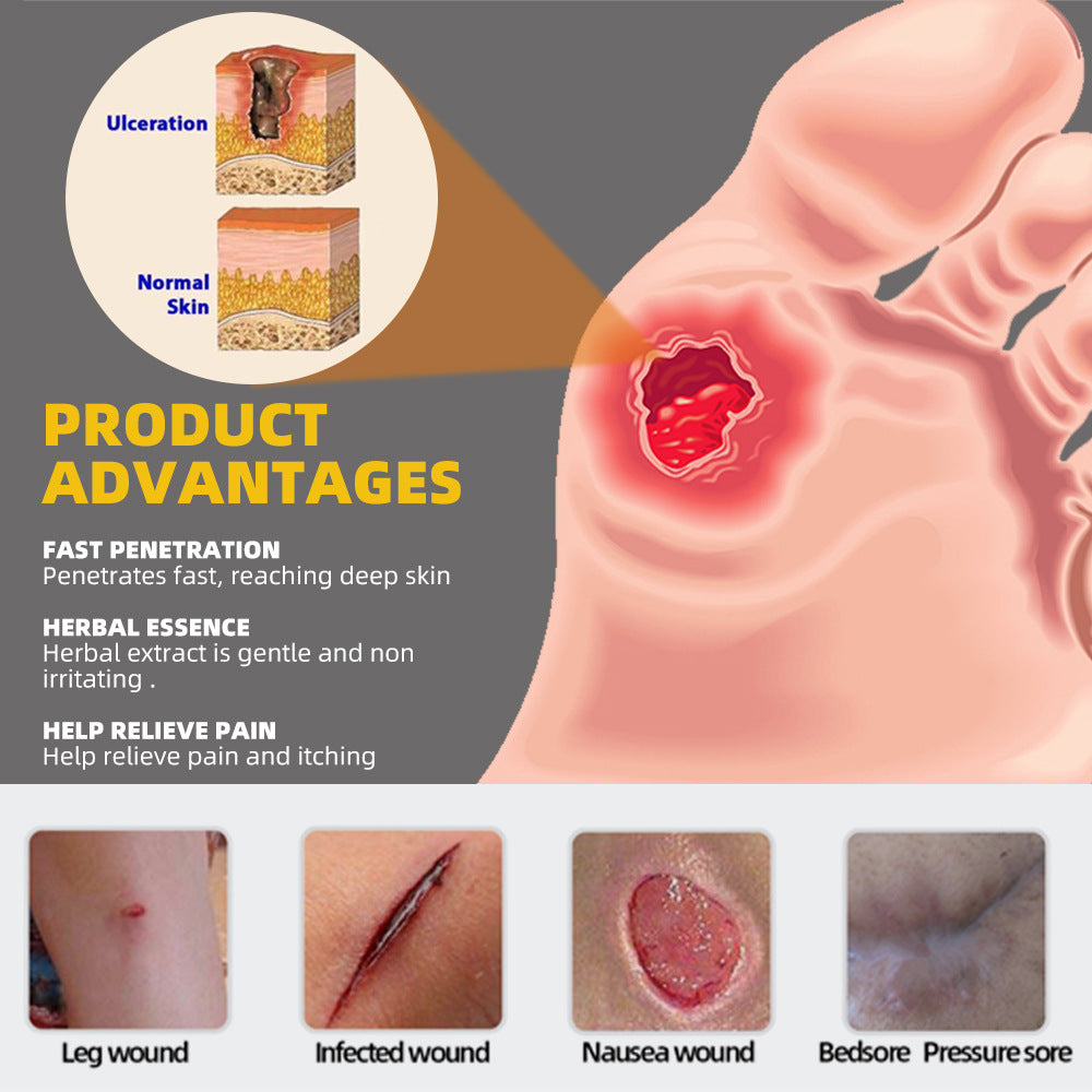 Bed Sores Cream | Herbal Ointment for Decubitus Ulcers, Wound Healing, and Pressure Ulcers - Image 2